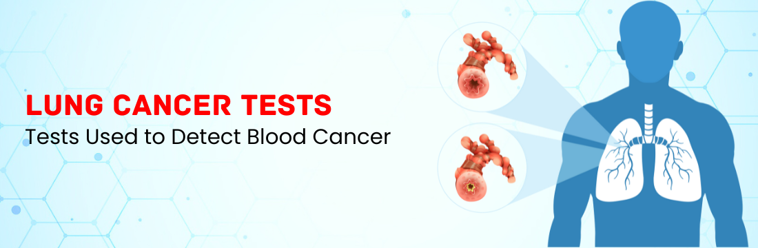 Lung Cancer: Tests and Treatment